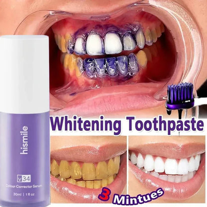 Hismile V34 Colour Corrector - Teeth Whitening